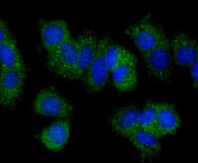 Immunocytochemistry/ Immunofluorescence: PLGF Antibody (JA63-15) [NBP2-67067]
