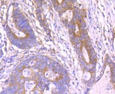 Immunohistochemistry-Paraffin: PLGF Antibody (JA63-15) [NBP2-67067]