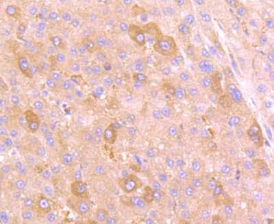 Immunohistochemistry-Paraffin: PLGF Antibody (JA63-15) [NBP2-67067]