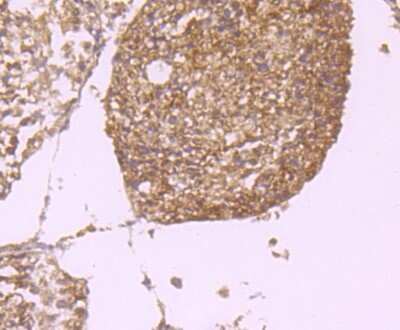 Immunohistochemistry-Paraffin: PLGF Antibody (JA63-15) [NBP2-67067]