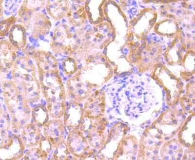 Immunohistochemistry-Paraffin: PLGF Antibody (JA63-15) [NBP2-67067]
