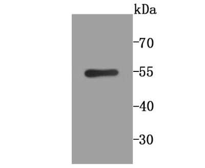 Western Blot: PLGF Antibody (JA63-15) [NBP2-67067]