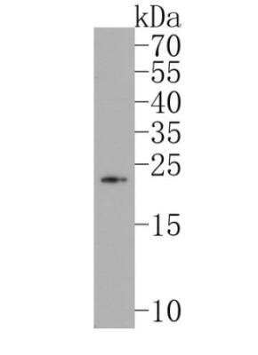 Western Blot: PLGF Antibody (JA63-15) [NBP2-67067]