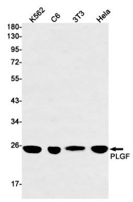 Western Blot: PLGF Antibody (S08-9C2) [NBP3-20019]