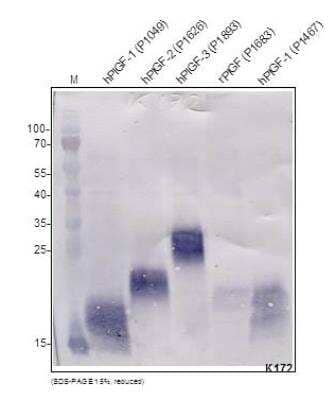 Western Blot: PLGF Antibody [NB600-1012]