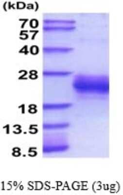 SDS-PAGE: Recombinant Mouse PLGF His Protein [NBP2-52173]