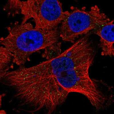 Immunocytochemistry/ Immunofluorescence: PLGLB1 Antibody [NBP2-56751]