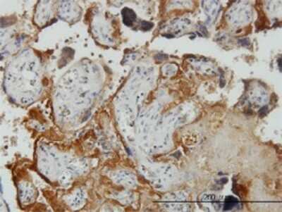 Immunohistochemistry-Paraffin: PLGLB2 Antibody (3E6) [H00005342-M04]
