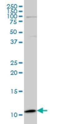 Western Blot: PLGLB2 Antibody (3E6) [H00005342-M04]