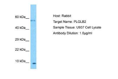 Western Blot: PLGLB2 Antibody [NBP2-84221]