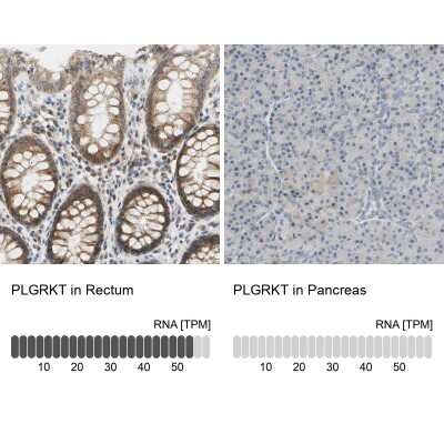 Immunohistochemistry-Paraffin: PLGRKT Antibody [NBP1-89254]