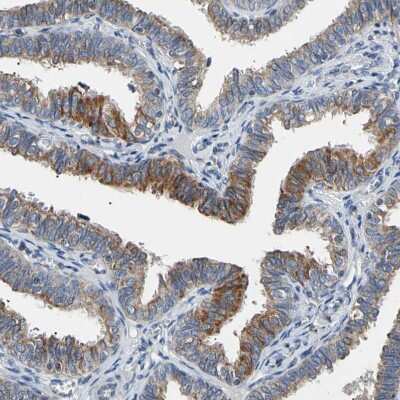 Immunohistochemistry-Paraffin: PLGRKT Antibody [NBP1-89254]