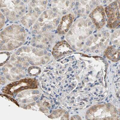 Immunohistochemistry-Paraffin: PLGRKT Antibody [NBP1-89254]