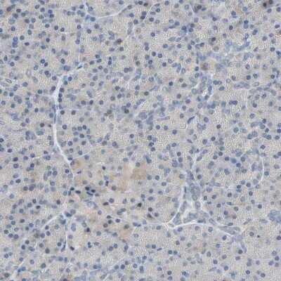 Immunohistochemistry-Paraffin: PLGRKT Antibody [NBP1-89254]