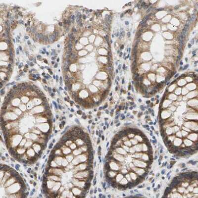 Immunohistochemistry-Paraffin: PLGRKT Antibody [NBP1-89254]