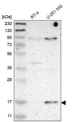 Western Blot: PLGRKT Antibody [NBP1-89254]