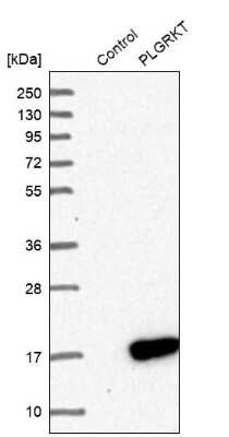 Western Blot: PLGRKT Antibody [NBP1-89254]