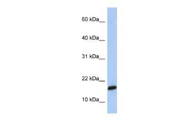 Western Blot: PLGRKT Antibody [NBP2-85499]