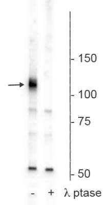 Western Blot: PLK1 [p Ser482, p Ser486, p Ser490] Antibody [NB300-278]