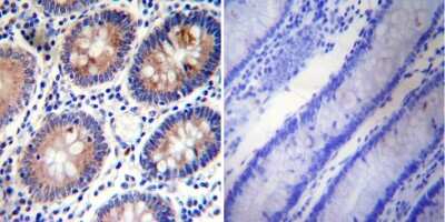 Immunohistochemistry-Paraffin: PLK1 Antibody (13E8) [NB100-74502]