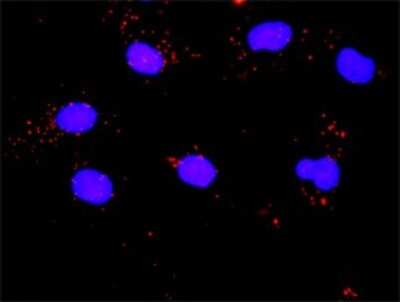 Proximity Ligation Assay: PLK1 Antibody (2G12) [H00005347-M01]