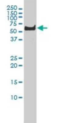 Western Blot: PLK1 Antibody (2G12) [H00005347-M01]
