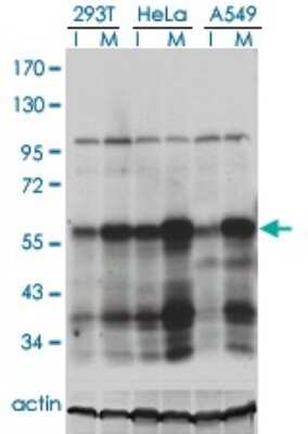 Western Blot: PLK1 Antibody (2G12) [H00005347-M01]