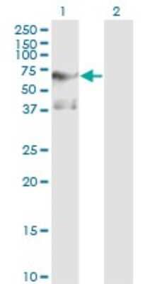 Western Blot: PLK1 Antibody (2G12) [H00005347-M01]