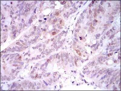 Immunohistochemistry-Paraffin: PLK1 Antibody (3C11) - BSA Free [NBP2-22196]