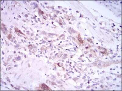 Immunohistochemistry-Paraffin: PLK1 Antibody (3C11) - BSA Free [NBP2-22196]