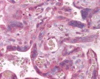 Immunohistochemistry-Paraffin: PLK1 Antibody [NB100-56651]