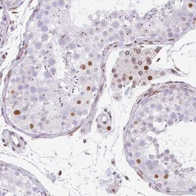 Immunohistochemistry-Paraffin: PLK1 Antibody [NBP2-49014]