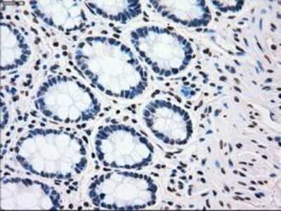 Immunohistochemistry: PLK1 Antibody (OTI1D4) - Azide and BSA Free [NBP2-73472]
