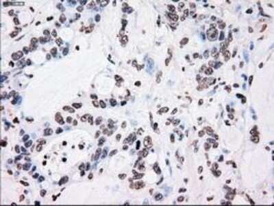 Immunohistochemistry: PLK1 Antibody (OTI1D4) - Azide and BSA Free [NBP2-73472]