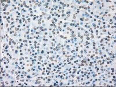 Immunohistochemistry: PLK1 Antibody (OTI1D4) - Azide and BSA Free [NBP2-73472]