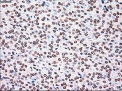Immunohistochemistry: PLK1 Antibody (OTI1D4) - Azide and BSA Free [NBP2-73472]