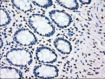 Immunohistochemistry-Paraffin: PLK1 Antibody (OTI1D4) [NBP1-48291]