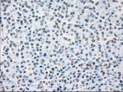 Immunohistochemistry-Paraffin: PLK1 Antibody (OTI1D4) [NBP1-48291]