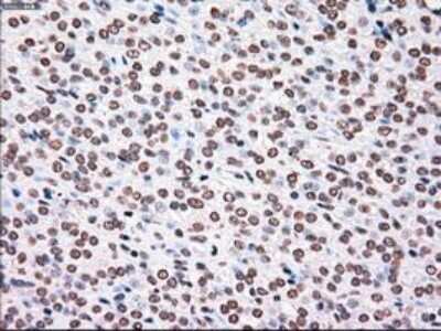 Immunohistochemistry-Paraffin: PLK1 Antibody (OTI1D4) [NBP1-48291]
