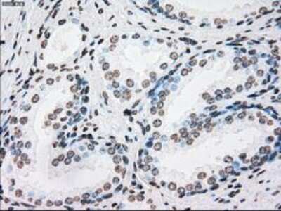 Immunohistochemistry-Paraffin: PLK1 Antibody (OTI1D4) [NBP1-48291]