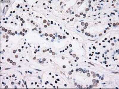 Immunohistochemistry-Paraffin: PLK1 Antibody (OTI1D4) [NBP1-48291]