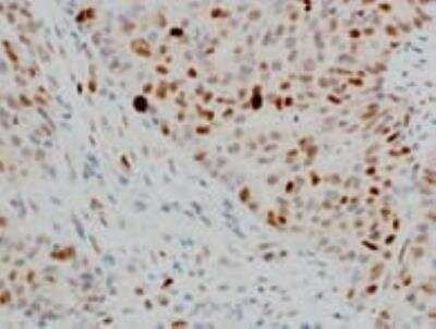 Immunohistochemistry-Paraffin: PLK1 Antibody (OTI1D4) [NBP1-48291]