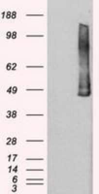 Western Blot: PLK1 Antibody (OTI1D4) [NBP1-48291]