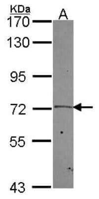 Western Blot: PLK2 Antibody [NBP2-15078]