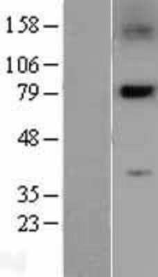 Western Blot: PLK2 Overexpression Lysate [NBL1-14516]