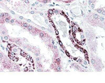 Immunohistochemistry-Paraffin: PLK3 Antibody [NBP2-26197]