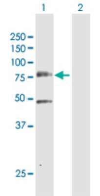 Western Blot: PLK3 Antibody [H00001263-D01P]