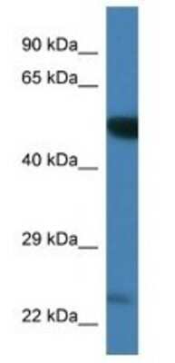 Western Blot: PLK3 Antibody [NBP1-74248]