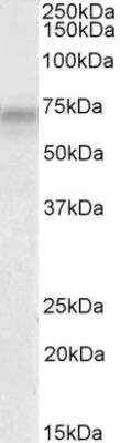 Western Blot: PLK3 Antibody [NBP2-26197]