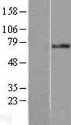 Western Blot: PLK3 Overexpression Lysate [NBL1-14517]